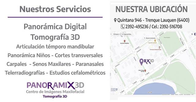 Panoramix 3D